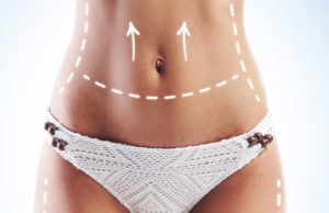 7 mód arra, hogyan szabaduljunk meg a cellulitisztől